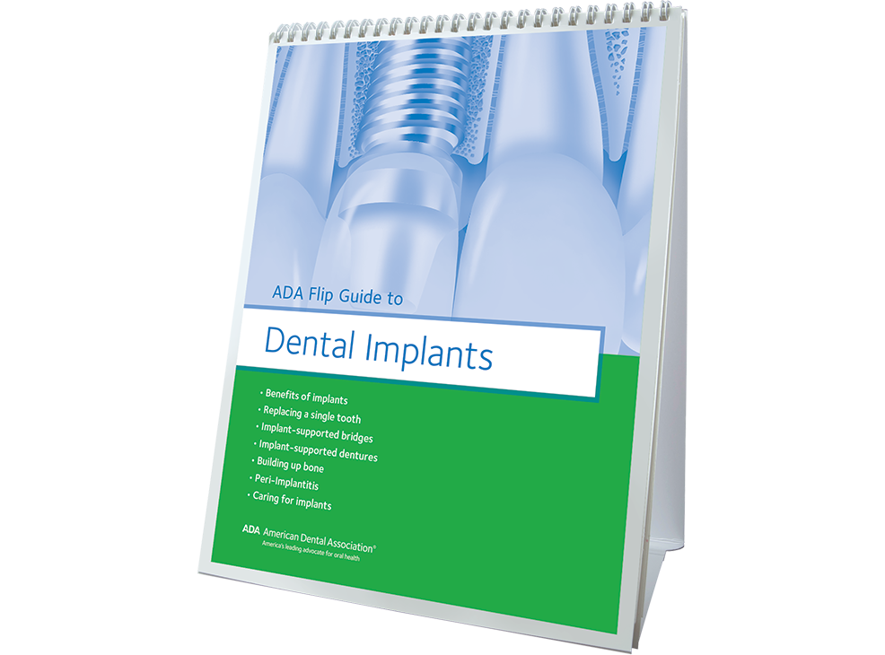 ADA Flip Guide To Dental Implants W483