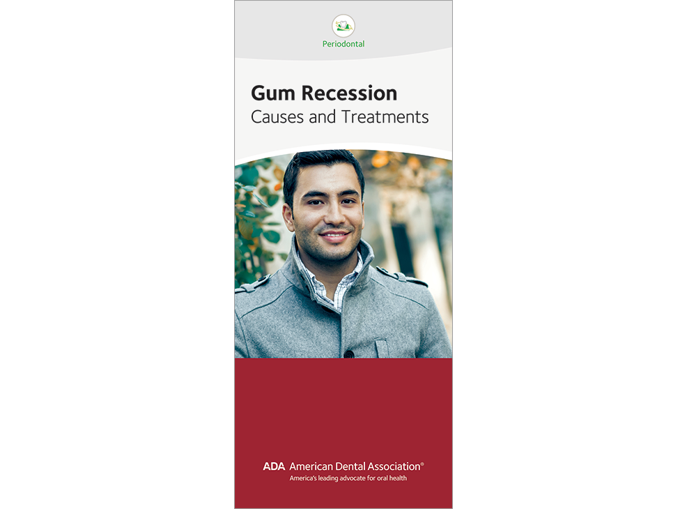 Gum Recession: Causes and Treatments Image 0