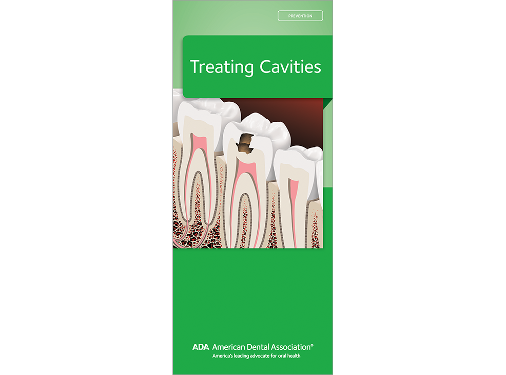 Treating Cavities Image 0