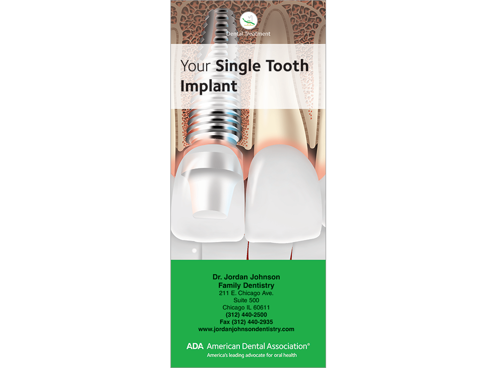 PERSONALIZED Your Single Tooth Implant Image 0
