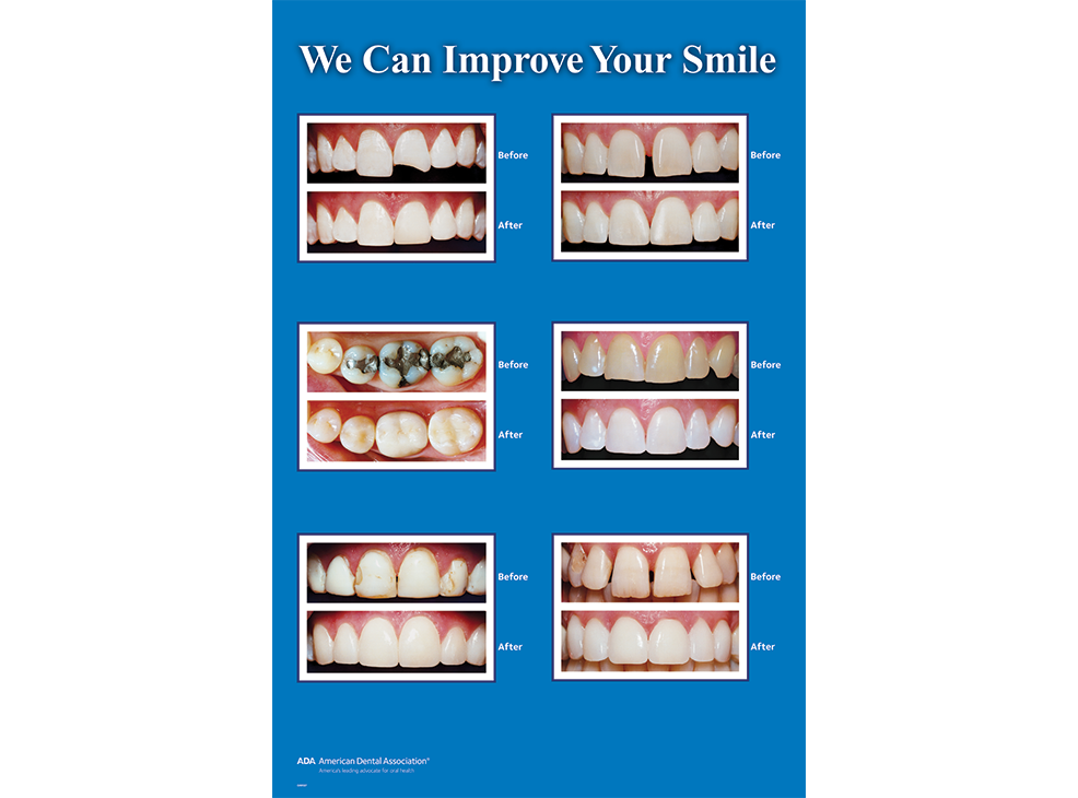 22" x 28" Unframed Wall Art, Improve Your Smile Image 0