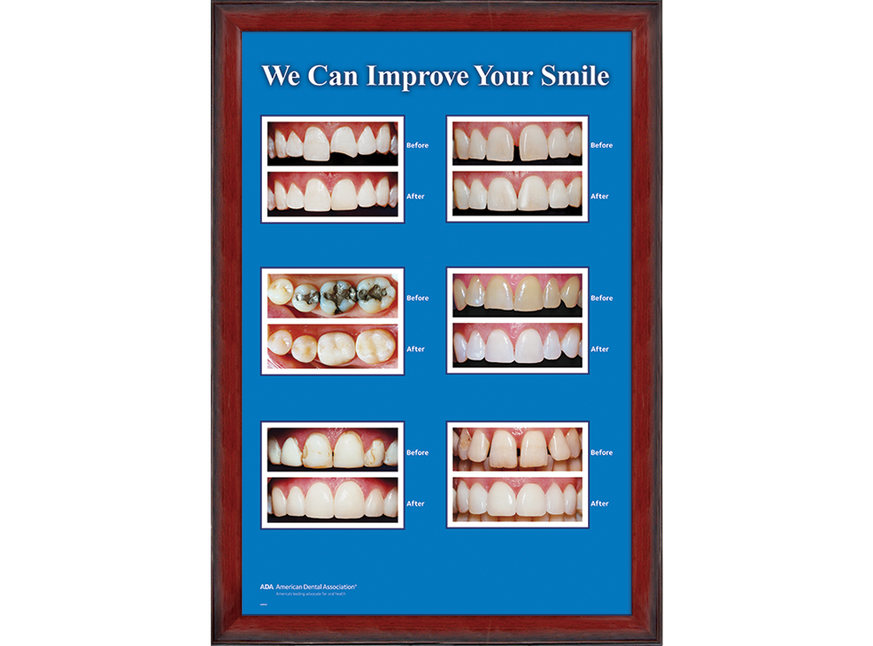 24" x 36" Framed Wall Art, Improve Your Smile Image 2