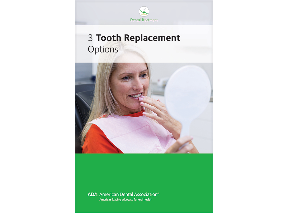 Three Tooth Replacement Options