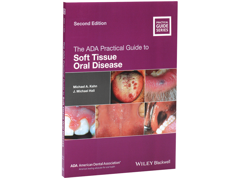 The ADA Practical Guide to Soft Tissue Oral Disease, Second Edition Image 0