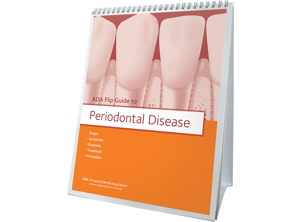 ADA Flip Guide to Periodontal Disease Image 0