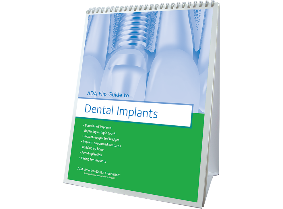 ADA Flip Guide to Dental Implants Image 0