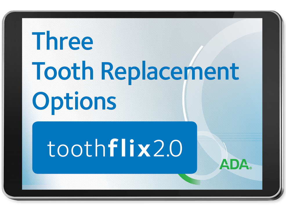 Three Tooth Replacement Options - Toothflix 2.0 Video Streaming Image 0