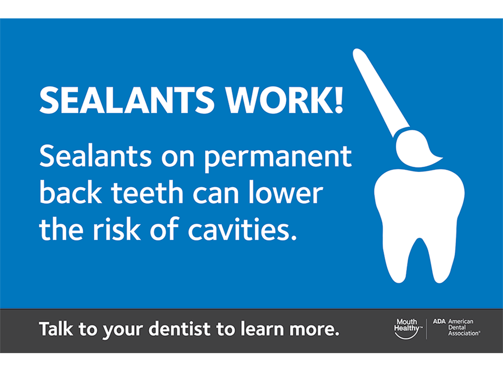 Dental Recall Card – Sealants Work Image 0