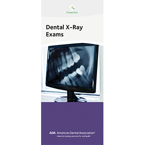 Dental X-Ray Exams Image 0