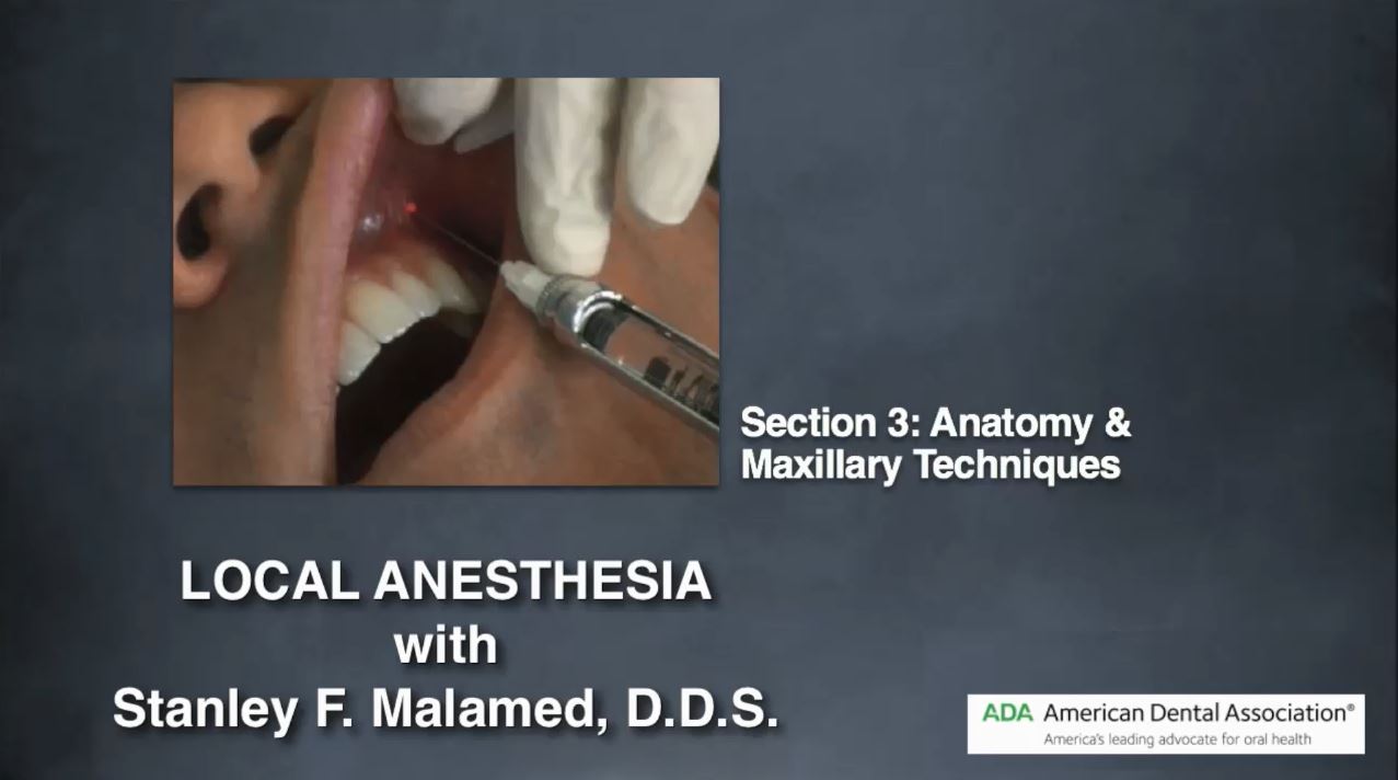 Local Anesthesia Part 3: Anatomy & Maxillary Techniques
