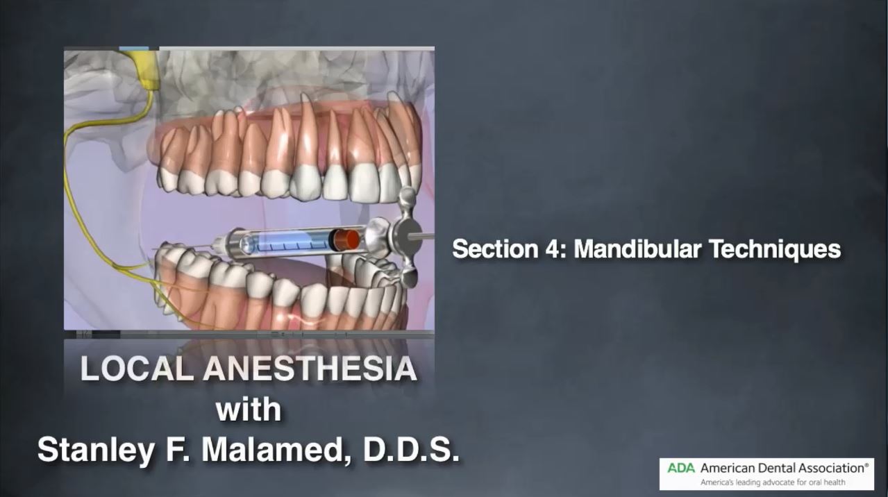 Local Anesthesia Part 4 & 5: Mandibular & Supplemental Techniques
