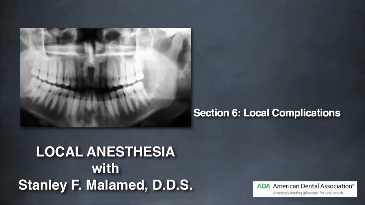 Local Anesthesia Parts 6 & 7: Local and Systemic Complications