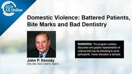 Domestic Violence: Battered Patients, Bite Marks and Bad Dentistry
