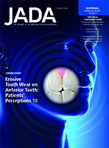 Are dental patients able to perceive erosive tooth wear on anterior teeth? (January 2020 Article 1)