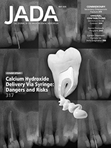 The double-edged sword of calcium hydroxide in endodontics (May 2020 Article 1)