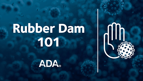 Rubber Dam 101 (Recorded Webinar)