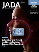 Intraoral radiographs — A comparison of dose and risk reduction with collimation and thyroid shielding (October 2020 Article 1)