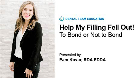 Help! My Filling Fell Out. To Bond or Not to Bond (Dental Team Education)
