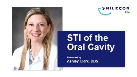 STI of the Oral Cavity
