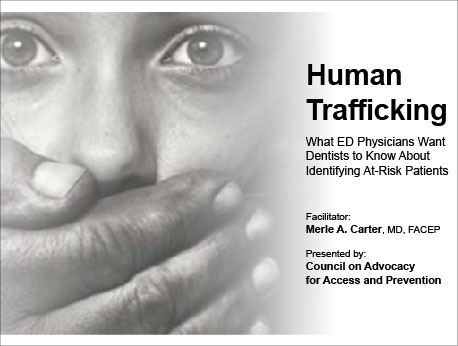 Human Trafficking: What ED Physicians Want Dentists to Know About Identifying At-Risk Patients (Recorded Webinar)