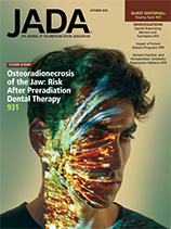 Effect of preradiation dental intervention on incidence of osteoradionecrosis in patients with head and neck cancer (October 2022 Article 1)