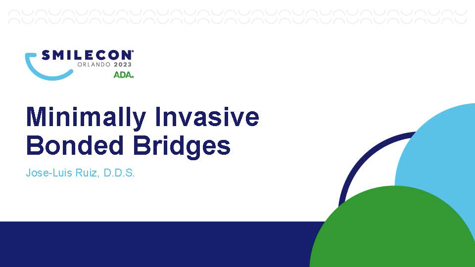Bridge to SmileCon: Minimally Invasive Bonded Bridges