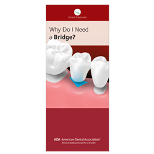 bridge ada why need w139 tooth replacement options w293 three ebusiness